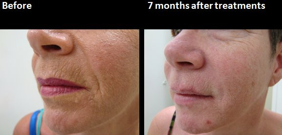 BA12 Tan QS gezicht vrouw