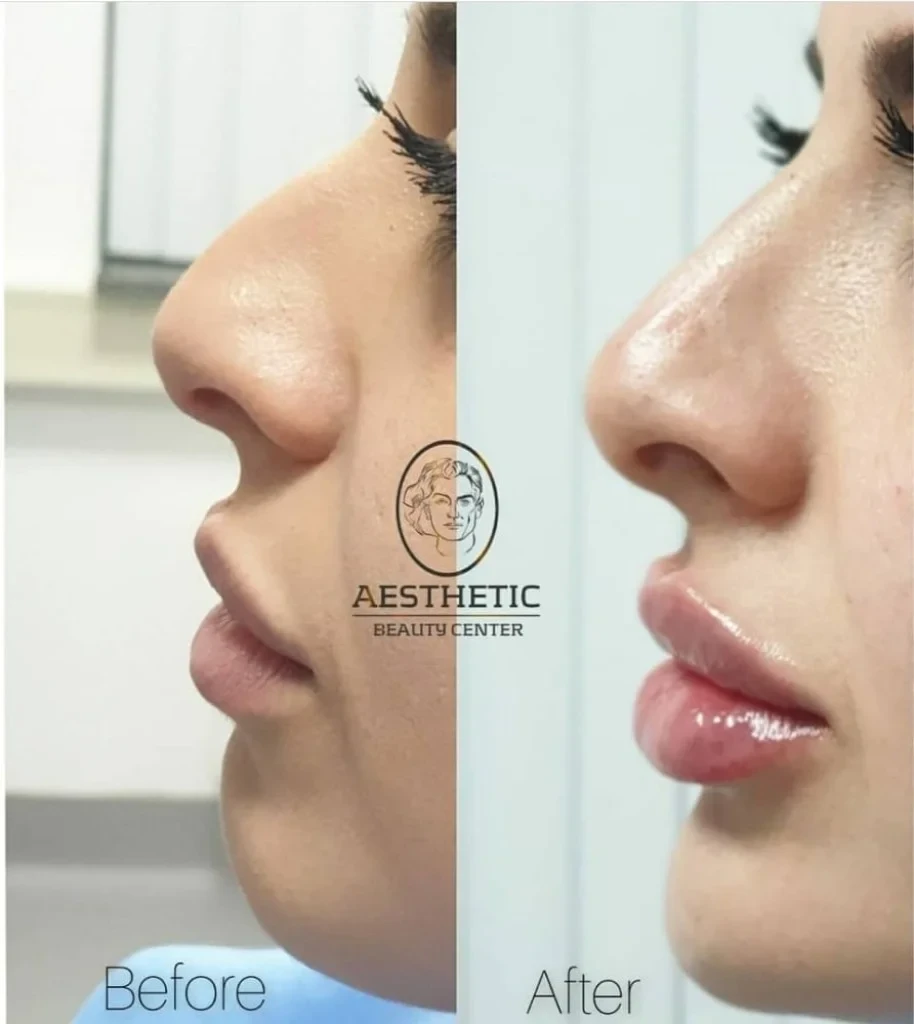 54sapxpyqth69b7dk48e.960x0