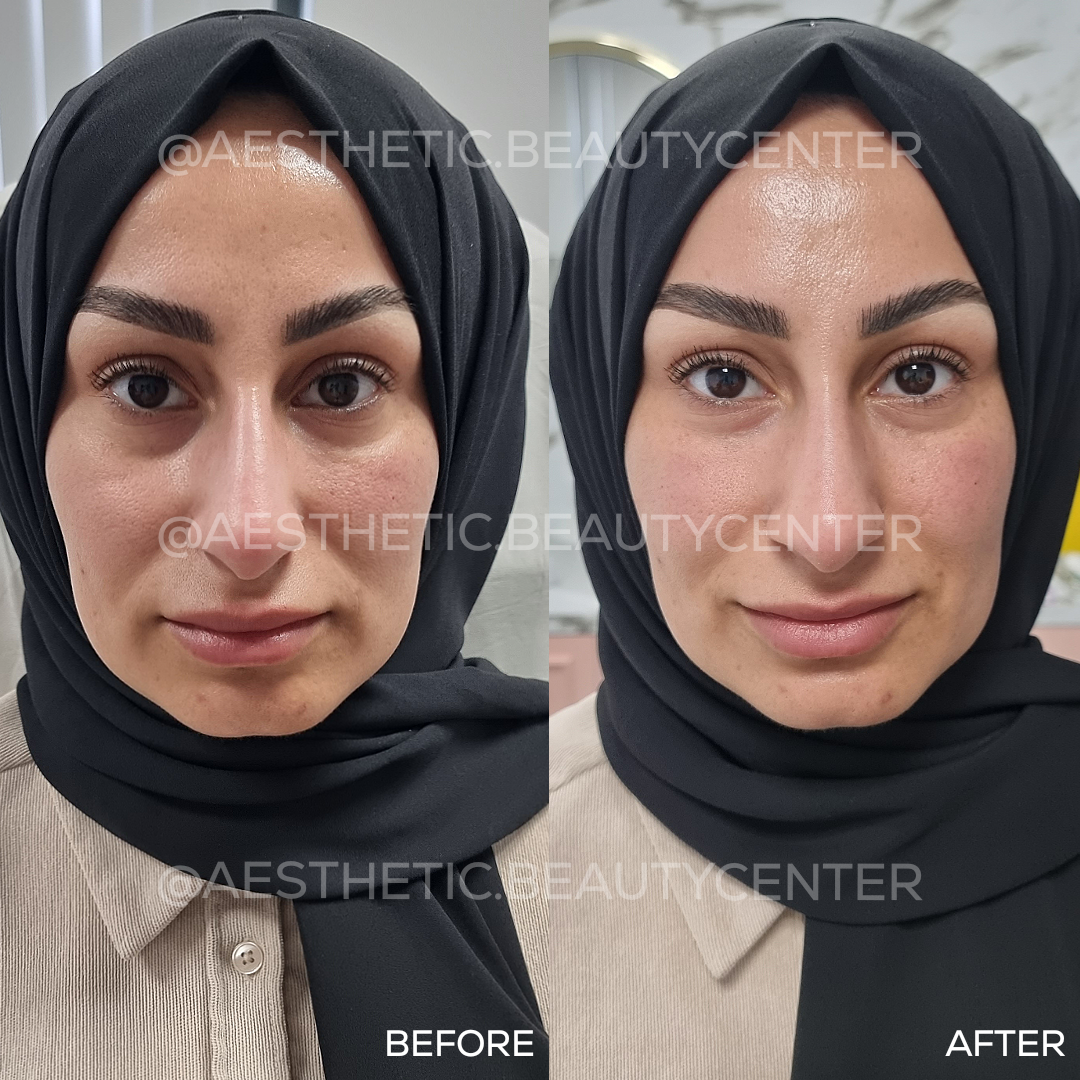 project-20240202-0941382-01.1280x0