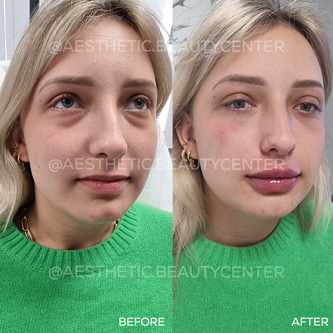 project-20240204-1413377-01.1280x0