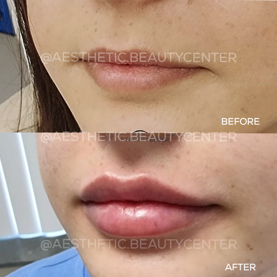 project-20240215-1516340-01.1280x0