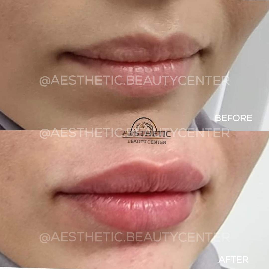 project-20240219-1407147-01.1280x0