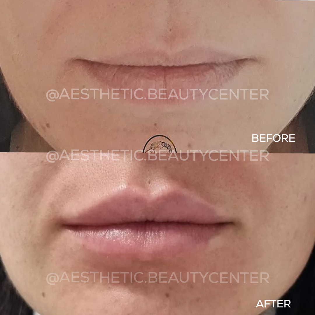 project-20240220-1351339-01.1280x0