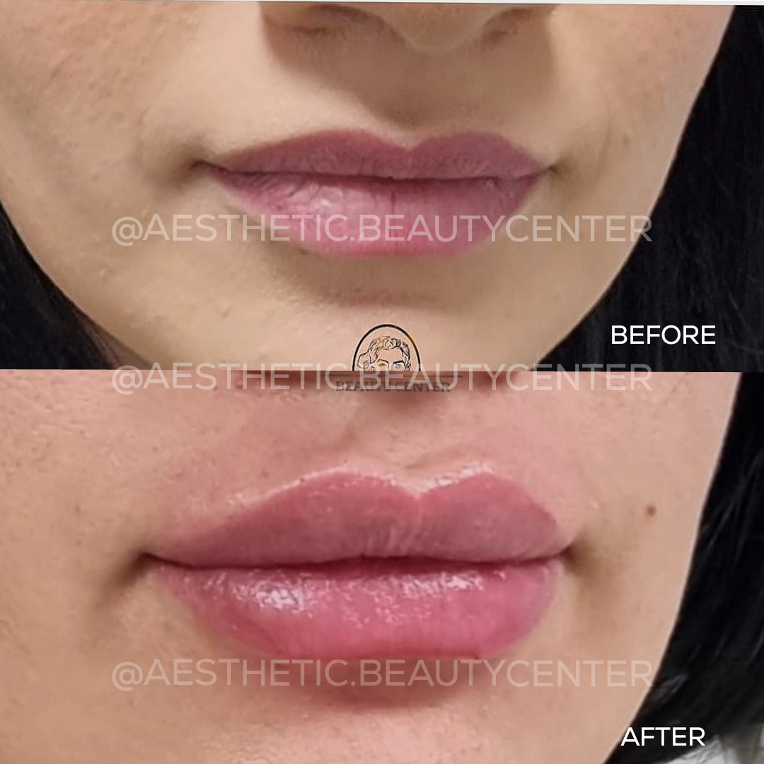 project-20240223-1133149-01.1280x0