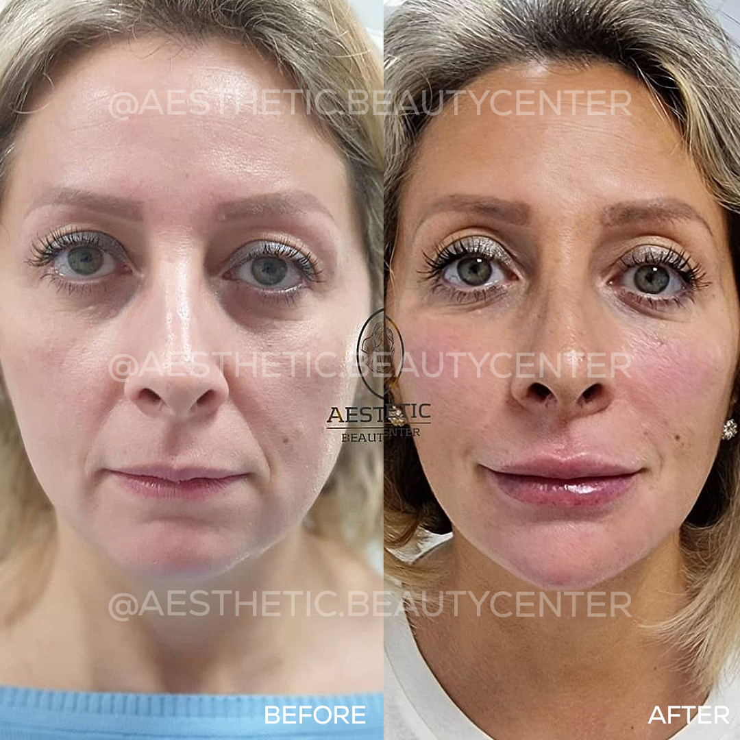 project-20240223-1143007-01-1.1280x0