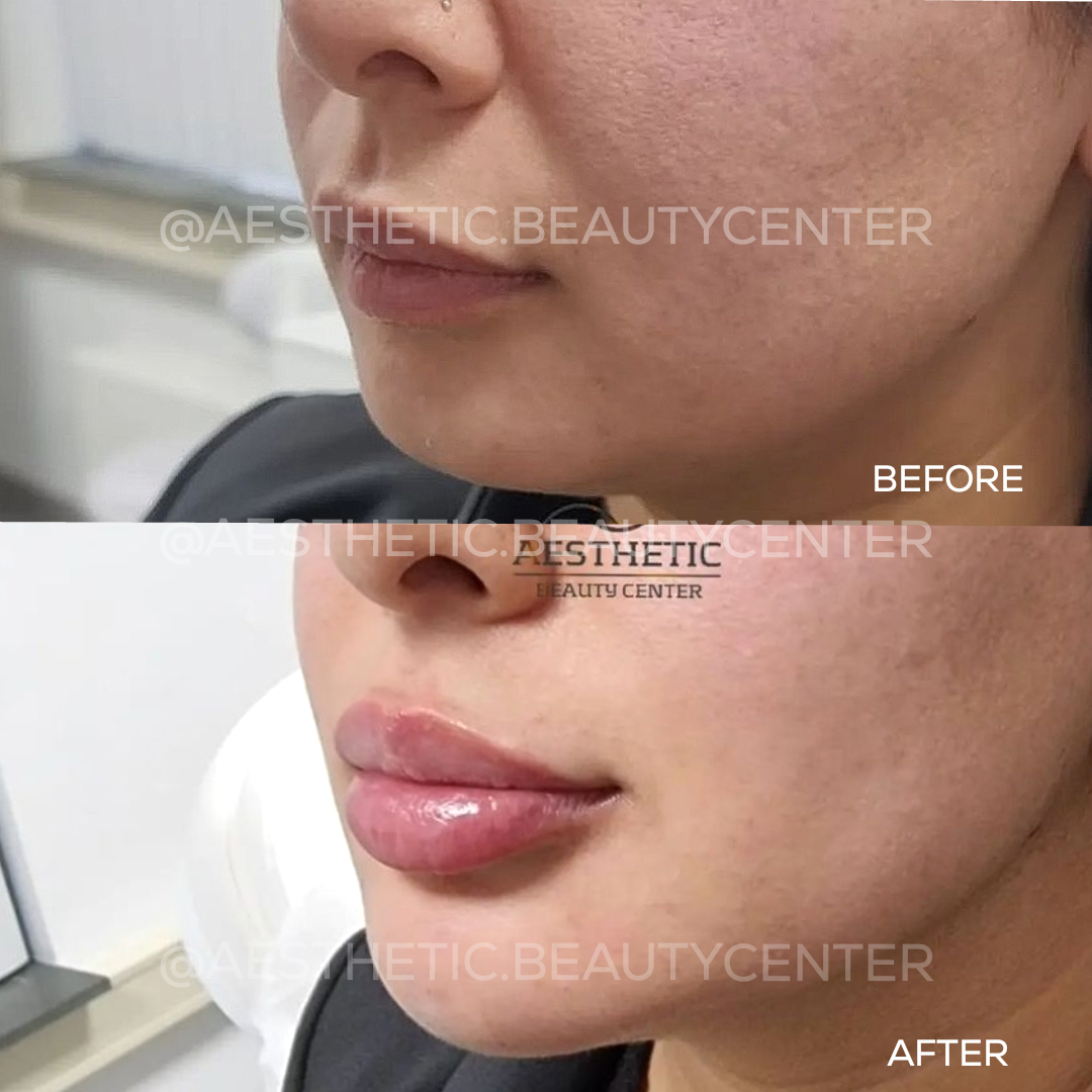 project-20240229-1239183-01.1280x0