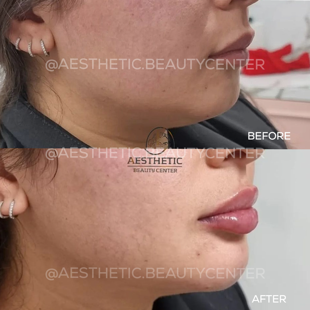 project-20240229-1242167-01-3.1280x0