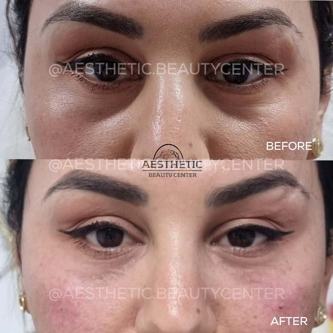 project-20240229-1244366-01.1280x0