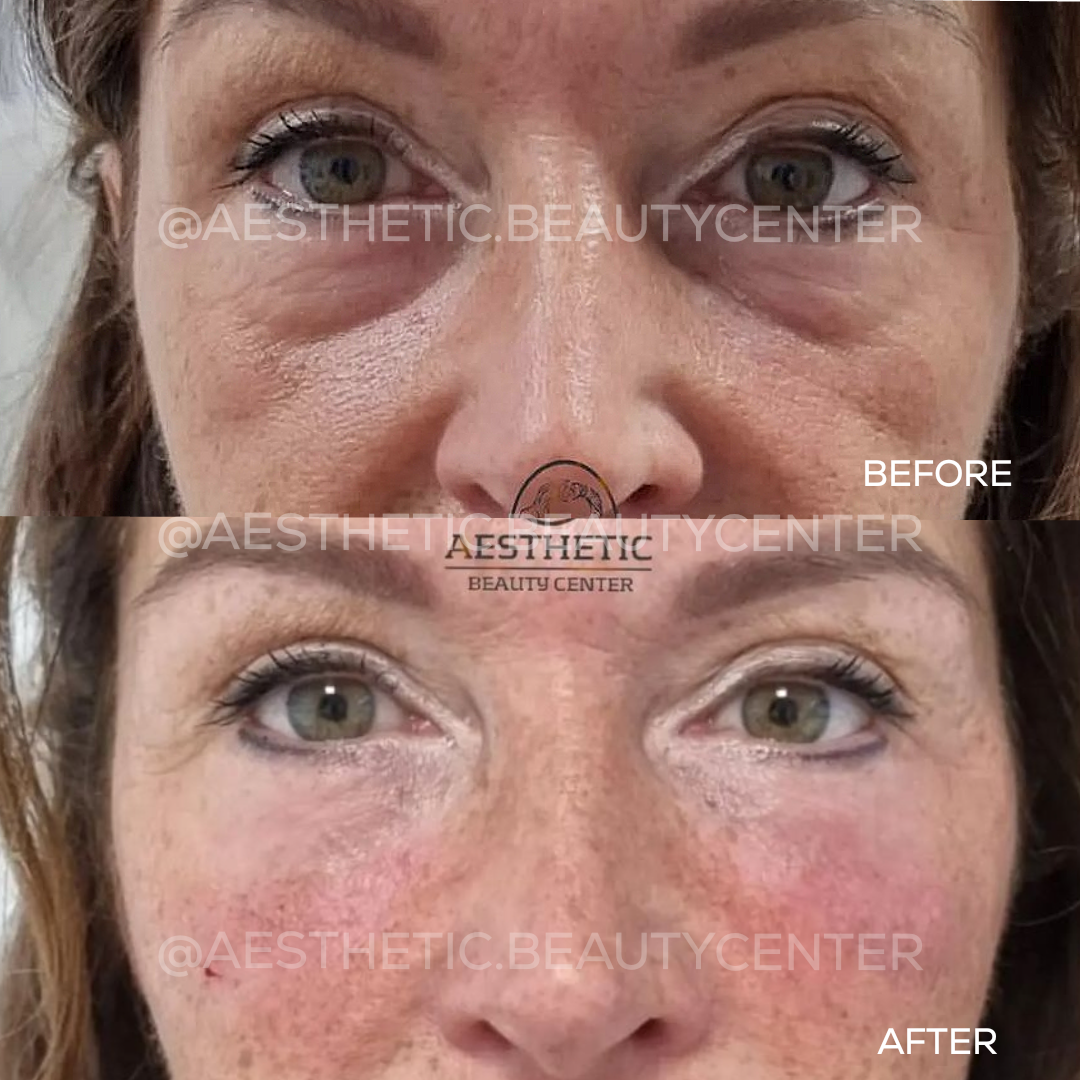 project-20240229-1248477-01.1280x0