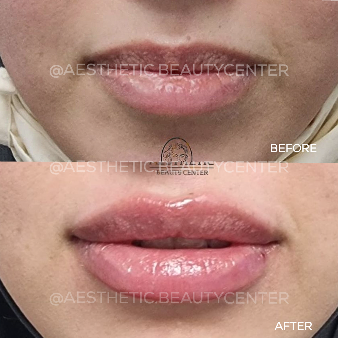 project-20240302-0844502-01.1280x0