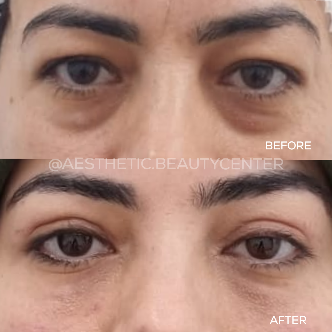 project-20240402-1220012-01-1.1280x0