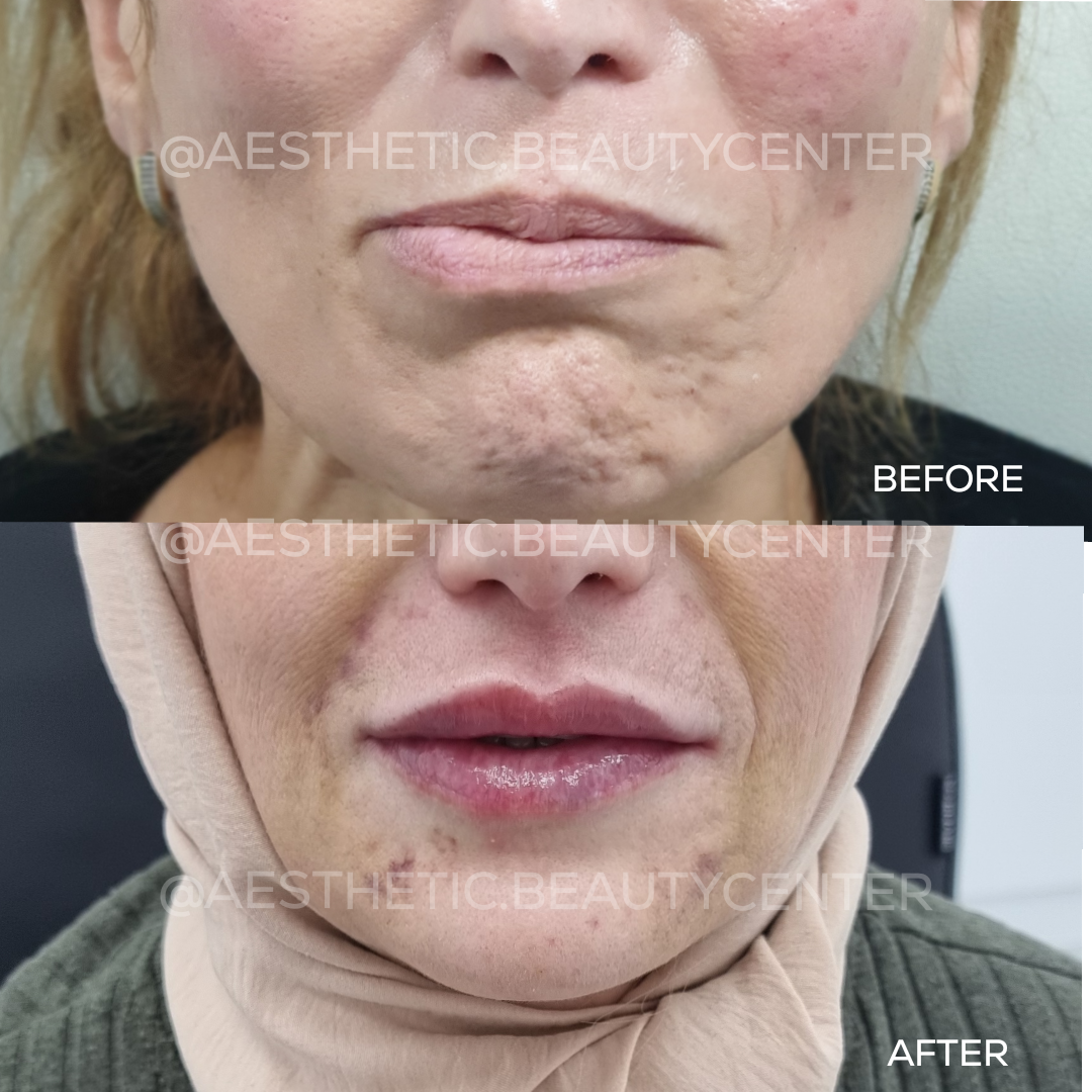 project-20231231-0857260-01.1280x0