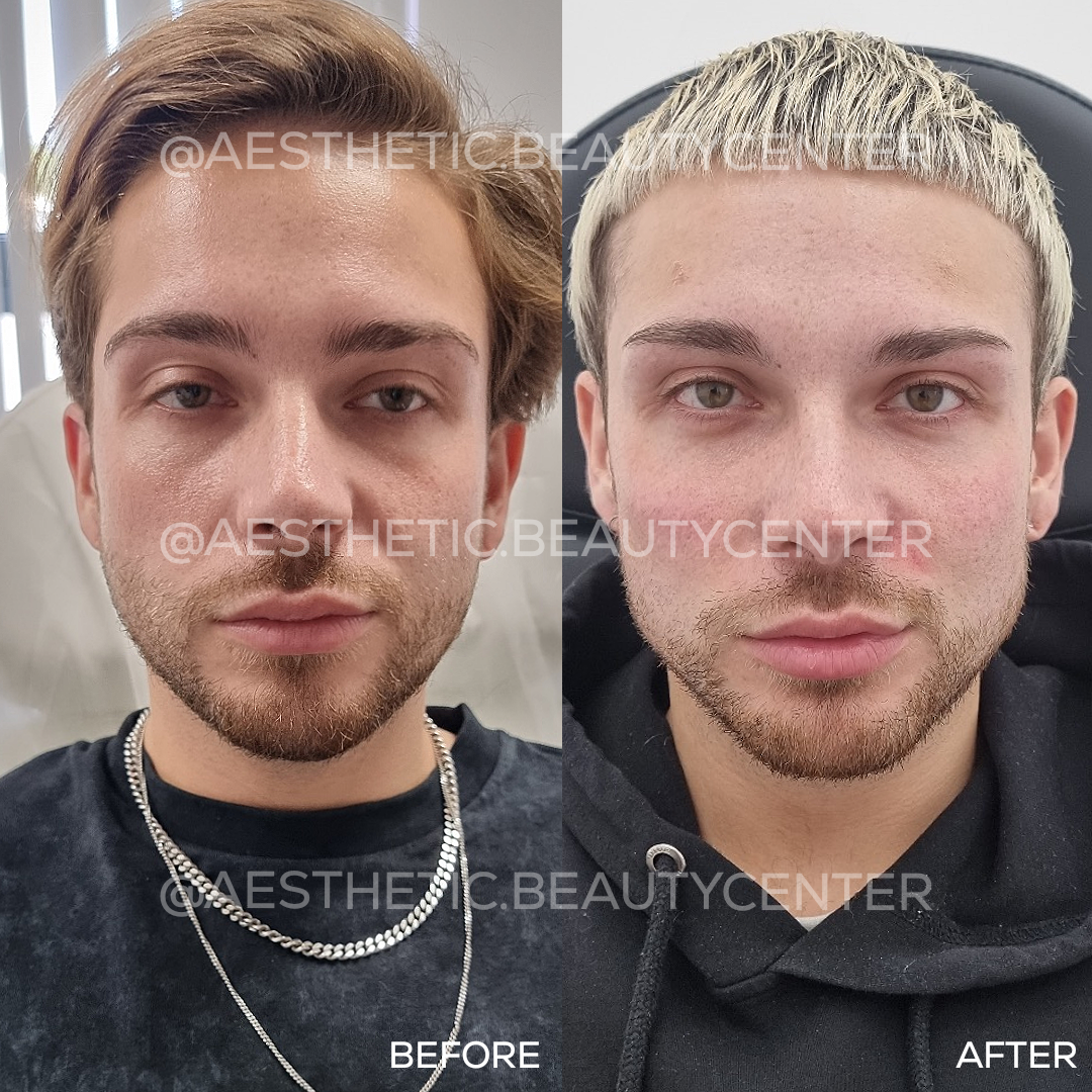 project-20240131-1107537-01.1280x0