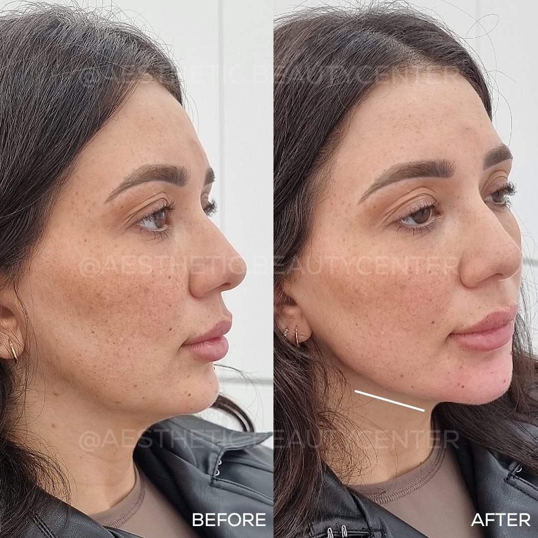 project-20240131-1121129-01.1280x0