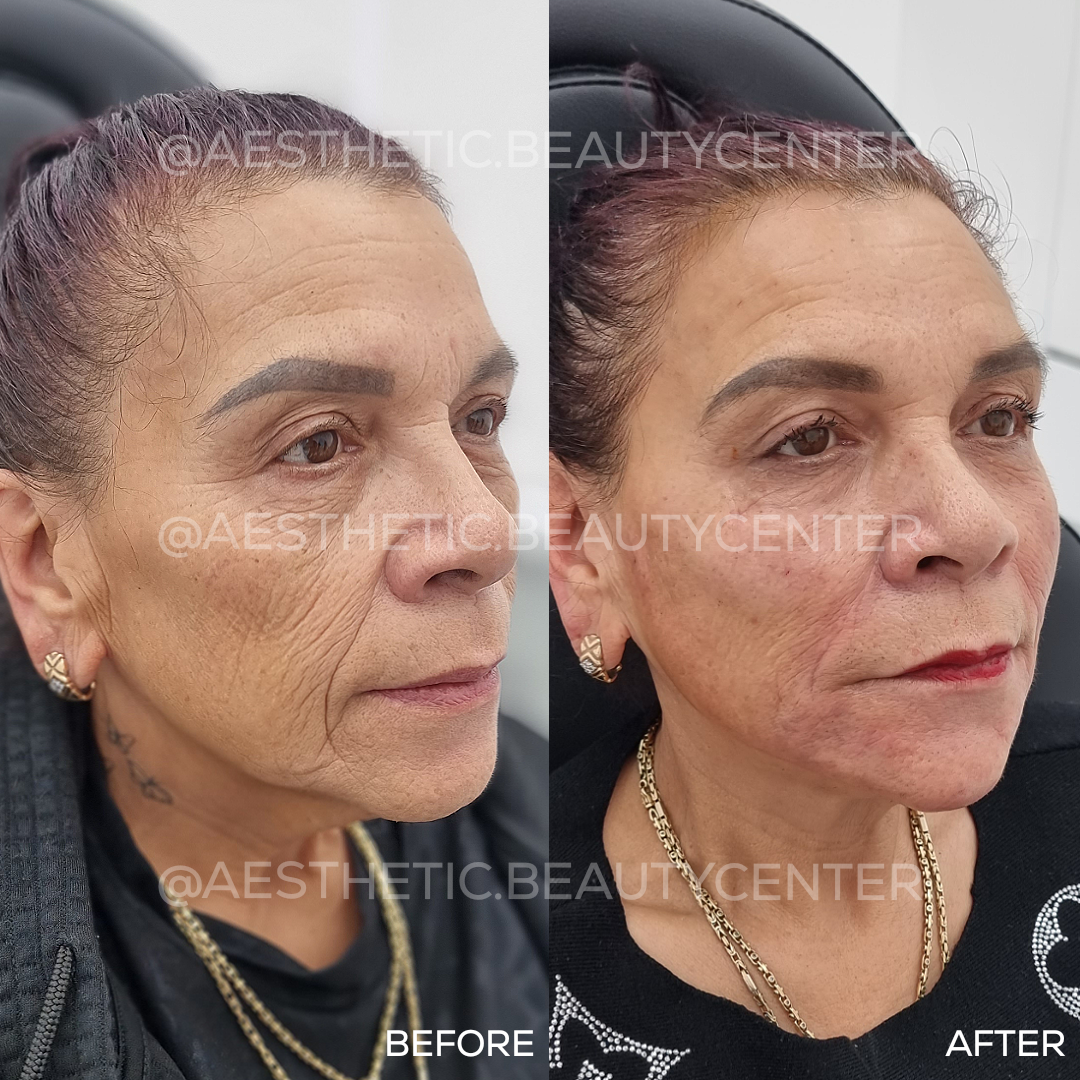 project-20240131-1132357-01.1280x0