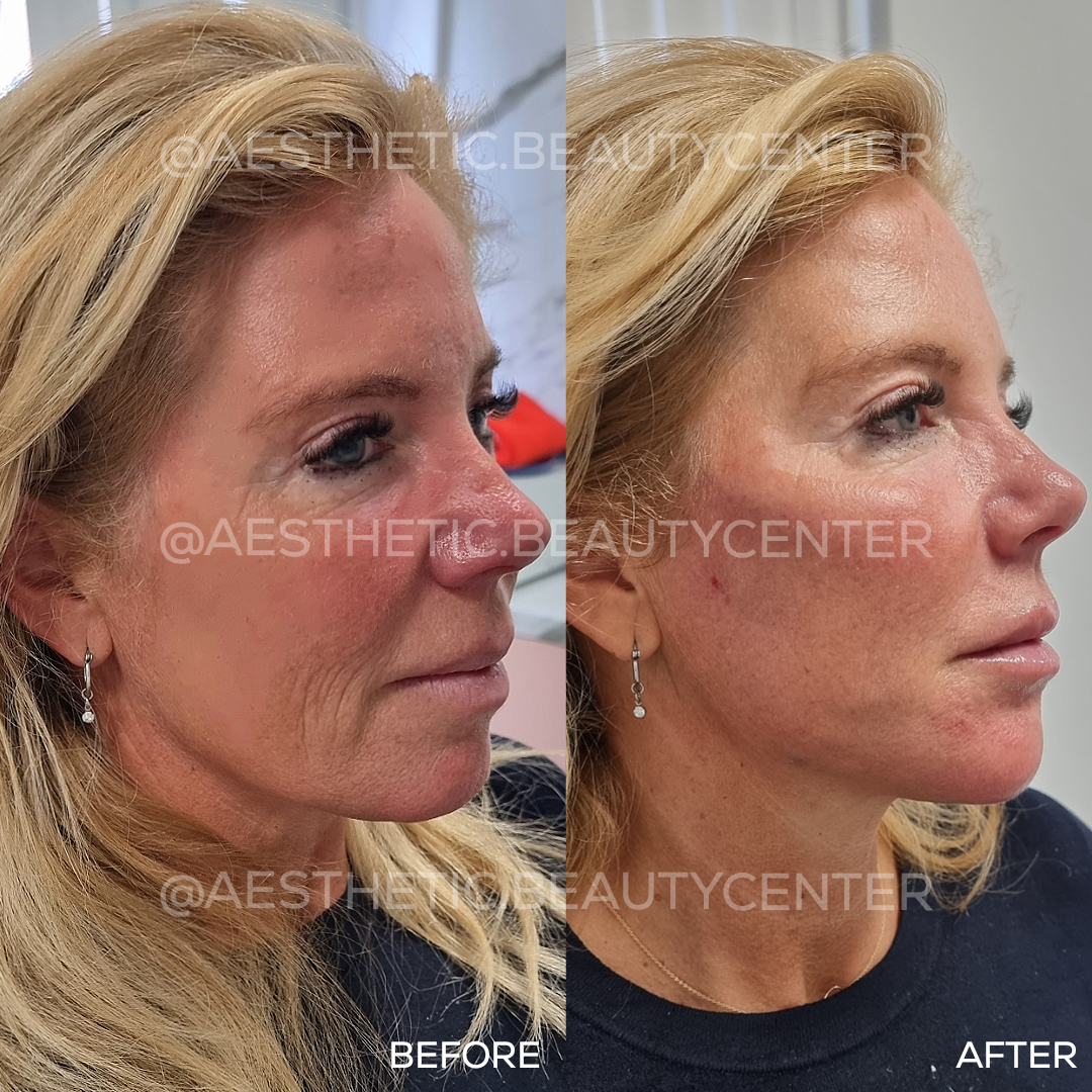 project-20240207-1137083-01.1280x0